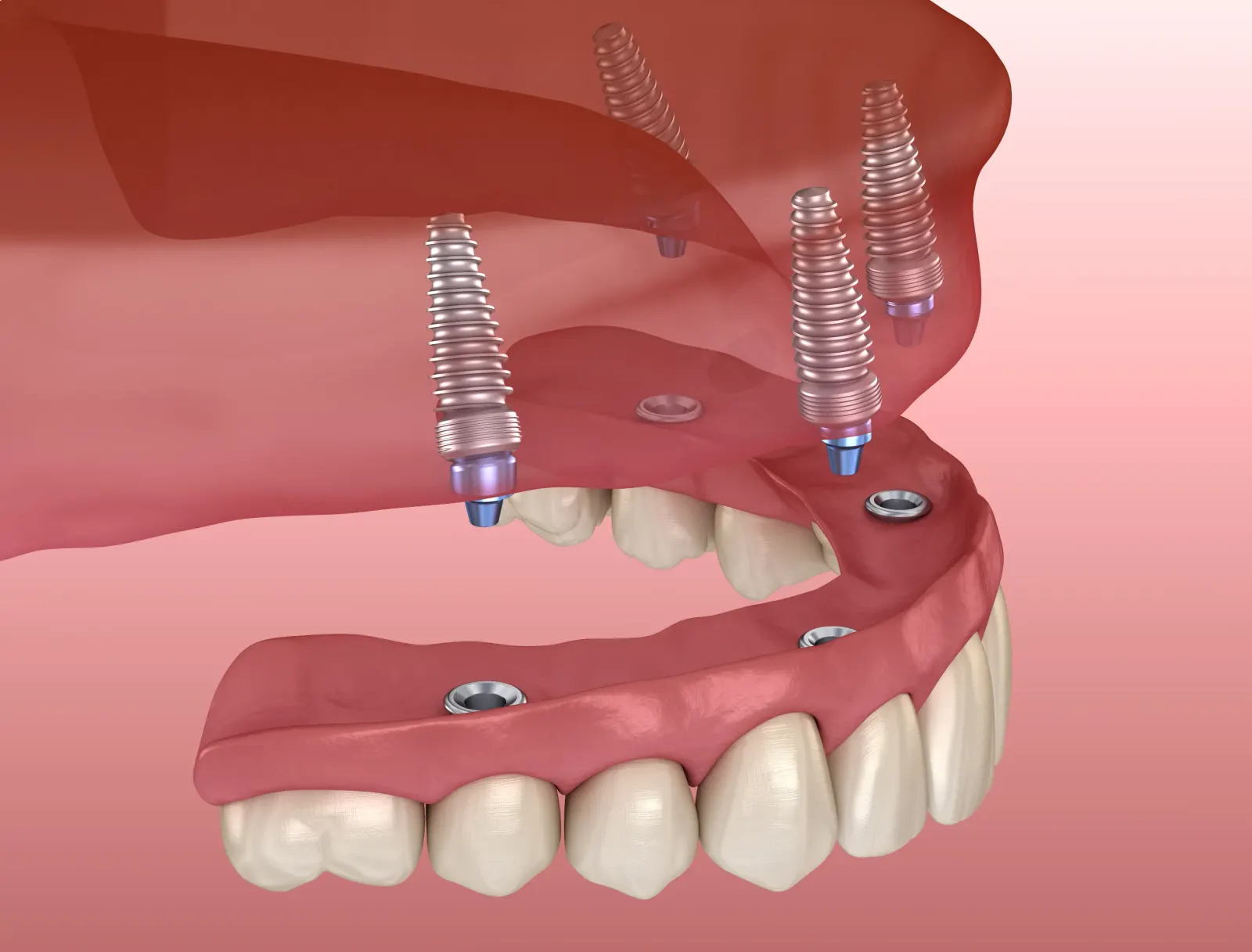 Understanding TMJ Treatment: Why It Matters for Your Health