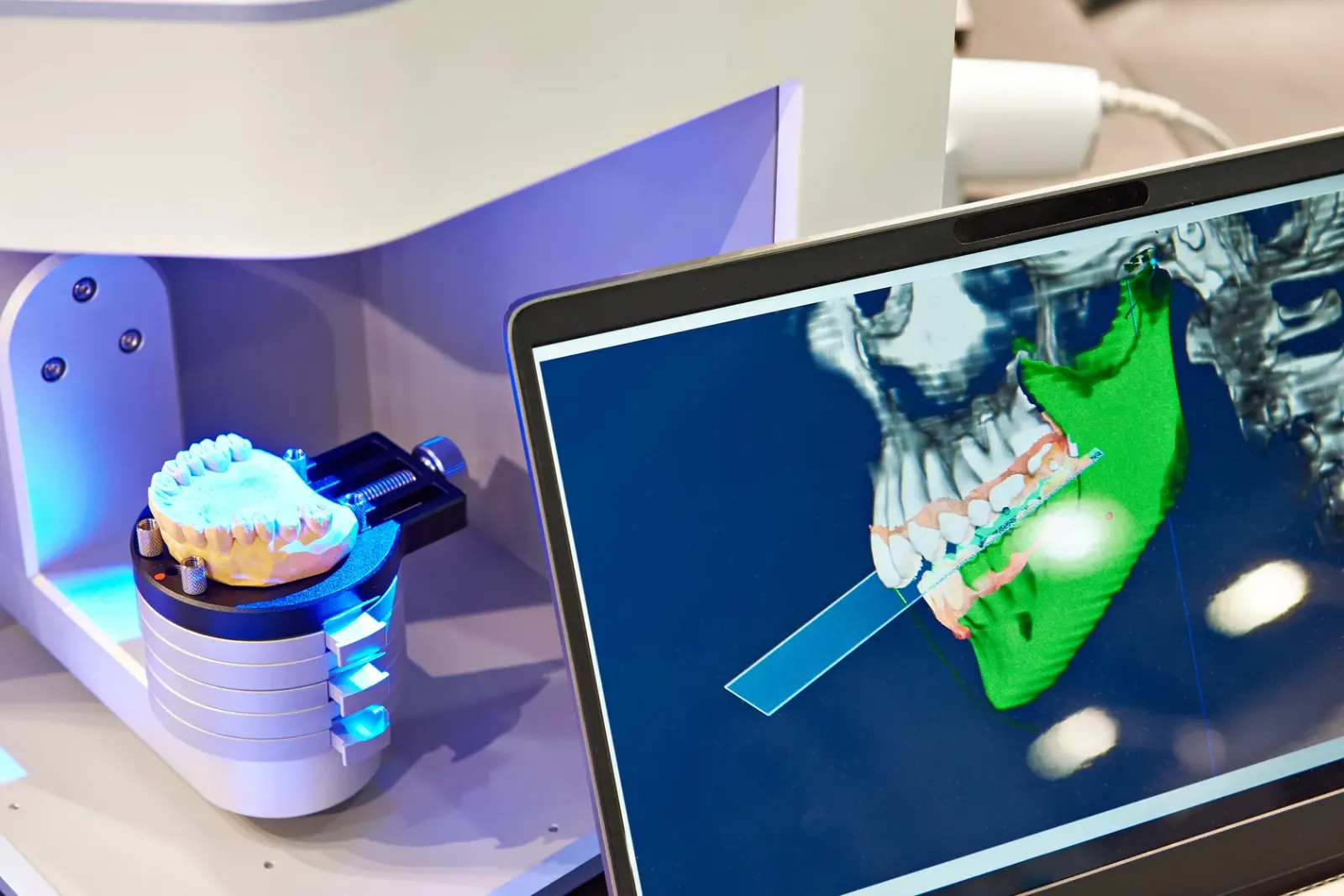 Digital Dentures