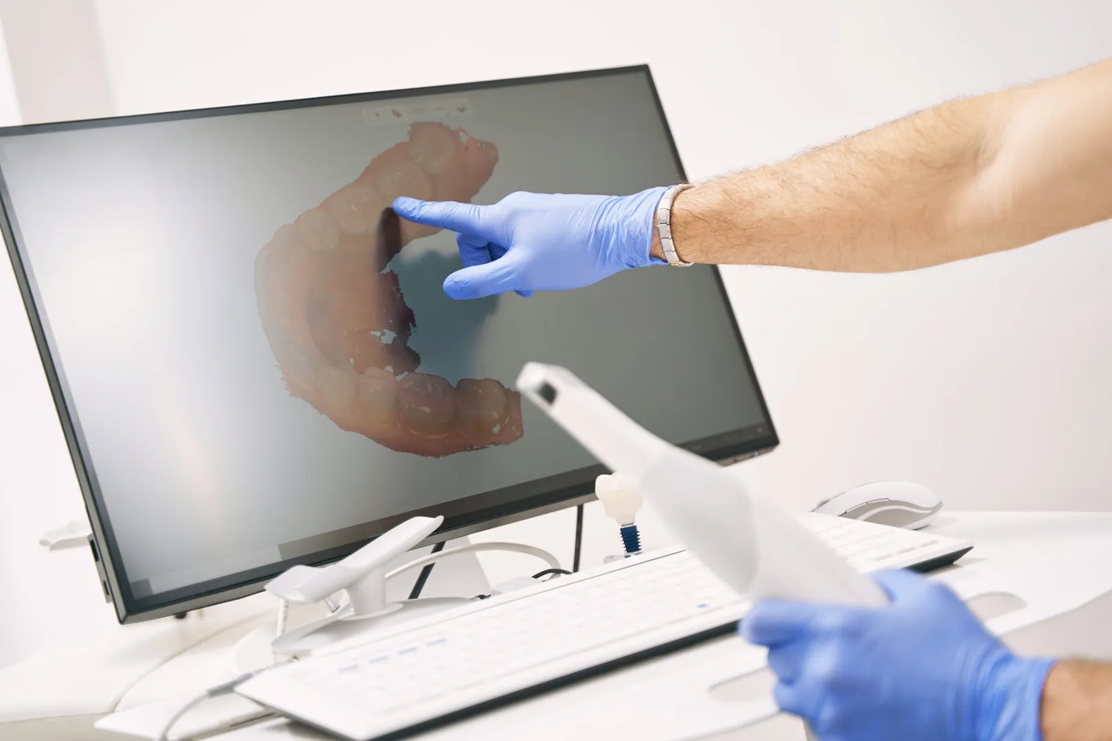 Digital Scanning at Foothills Family Dental
