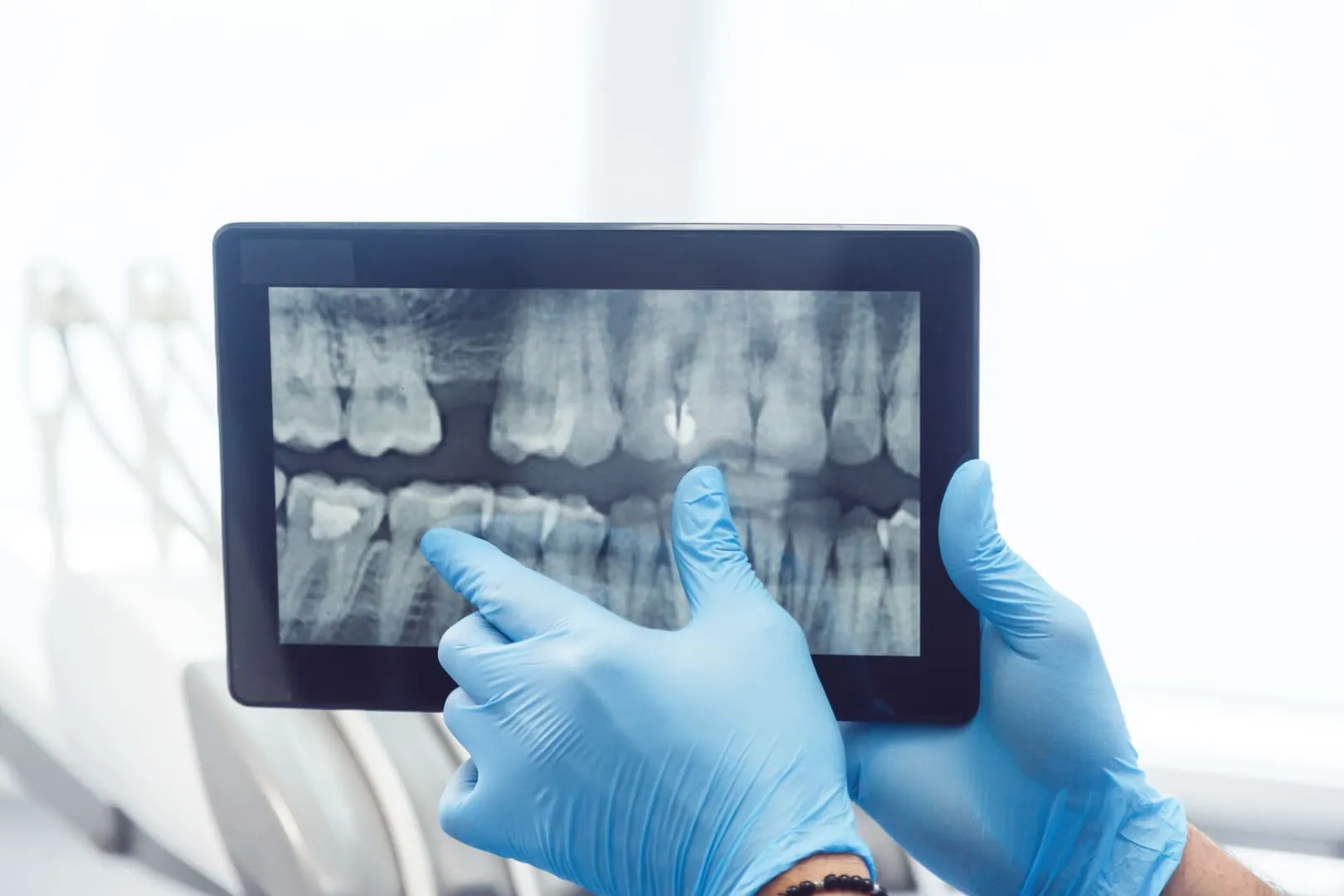 Digital X-Rays at Foothills Family Dental