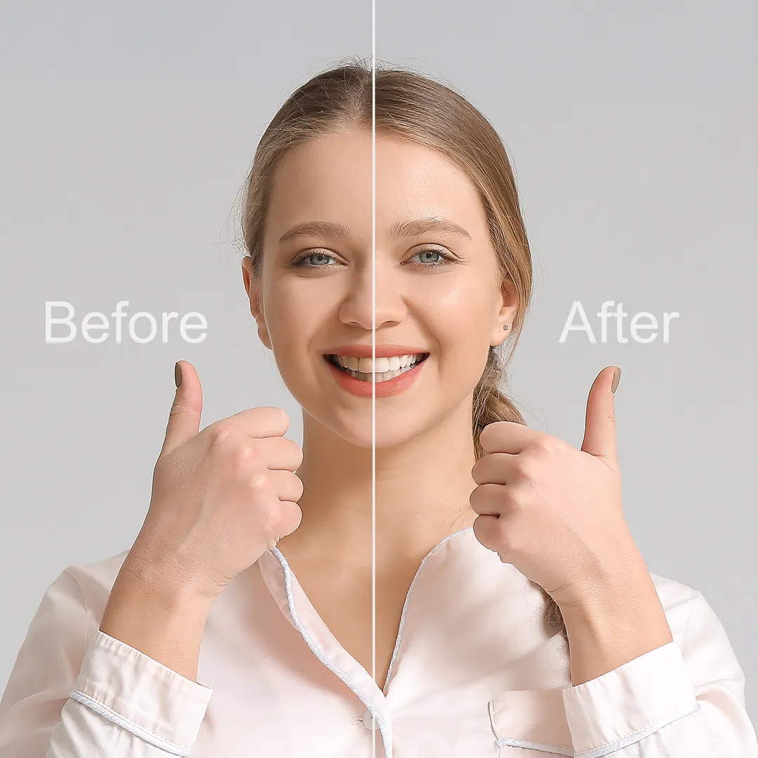 Full Mouth Reconstruction at Foothills Family Dental