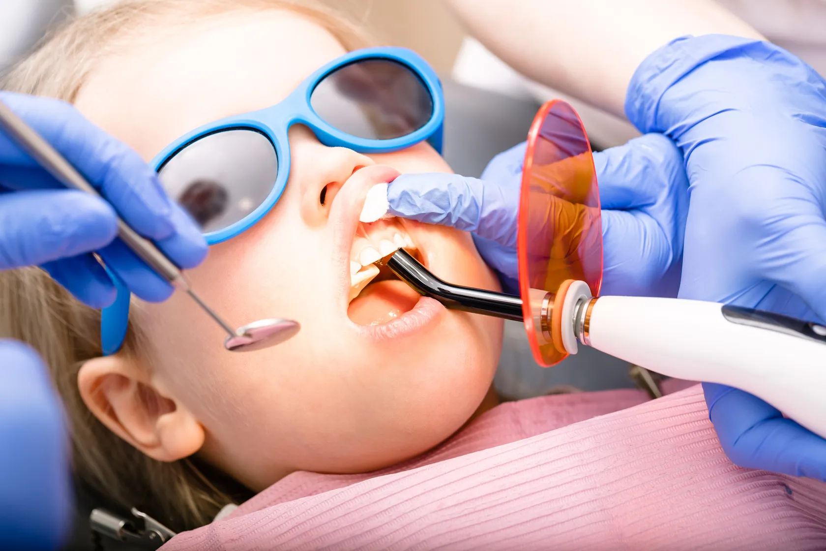 Pediatric Fillings